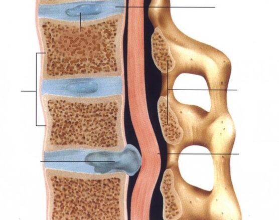 The hernias are pronounced