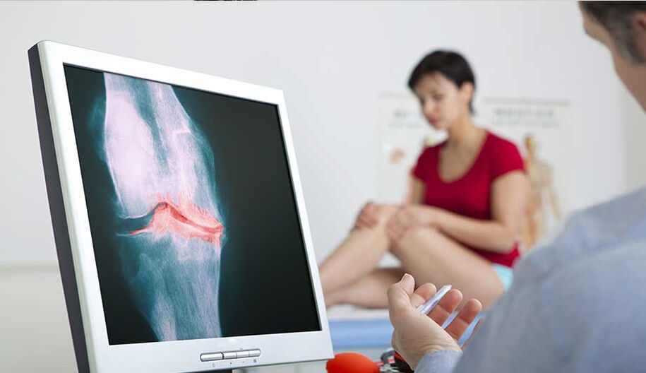 Consultation with a doctor if arthritis or osteoarthritis is suspected