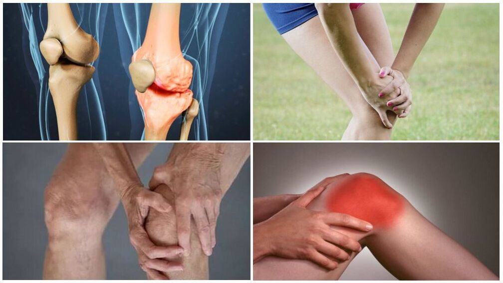 Osteoarthritis phase