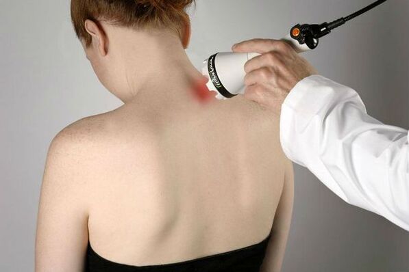 Physiotherapeutic measures for the treatment of cervical osteochondrosis