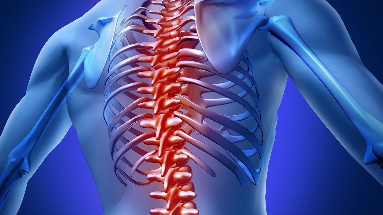 Thoracic osteochondrosis