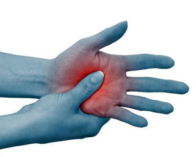 Severe pain in the finger joints, which decreases with exercise, is a typical sign of rheumatoid arthritis.